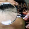 抜け毛、ニオイ、かゆみ…40代男性の頭皮トラブルを根本から見直す方法